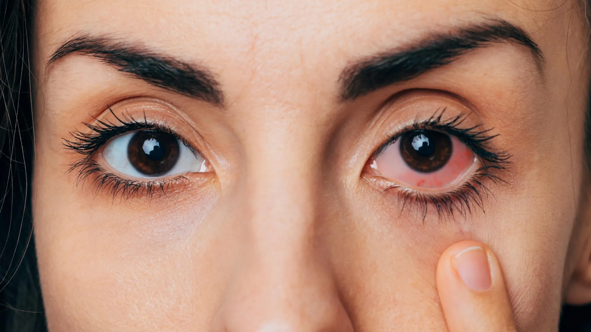 Pusė suaugusiųjų patiria sauso akies problemą, bet dauguma jų niekada neskundžia padėtis gauti.