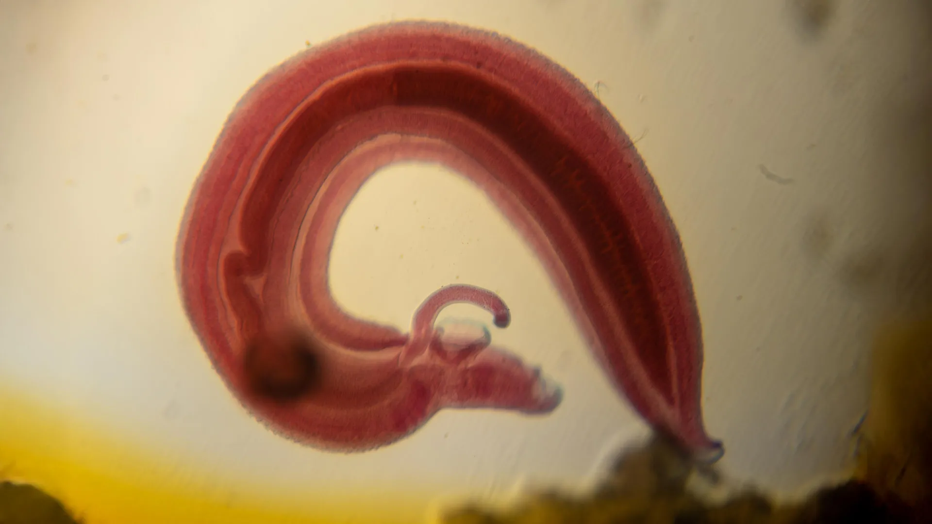 Parasite Disrupts Pain Signaling in Host Organisms